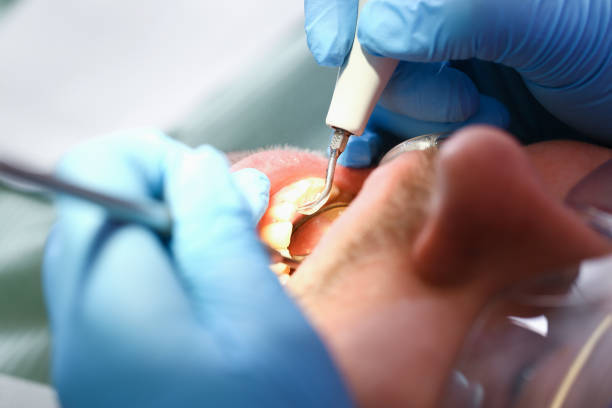 Best Emergency Broken Tooth Repair in Riverside, IL