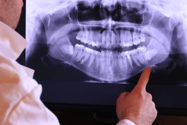 Best Emergency Root Canal Treatment in Riverside, IL